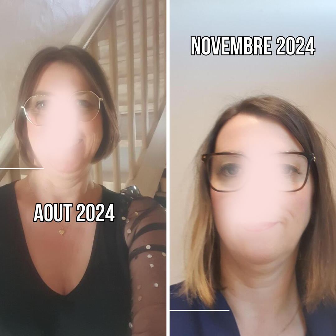 VIRAL - Lotion Sans Rinçage Pousse Extrême & Anti Chute de Cheveux - 100 ml [PRE-COMMANDE]